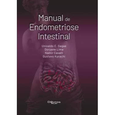 Imagem de Manual De Endometriose Intestinal