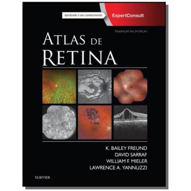 Imagem de Atlas de retina - elsevier