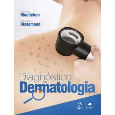 Imagem de Diagnostico Em Dermatologia - 1ª Ed