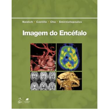 Imagem de Livro - Imagem Do Encéfalo