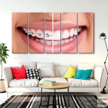 Imagem de Quadro Decorativo Dentista Aparelho 140x65 - Wall Frame