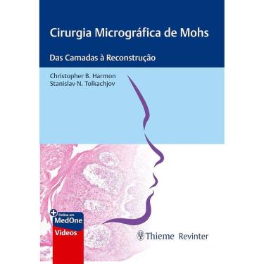 Imagem de Cirurgia Micrográfica de Mohs: Das Camadas À Reconstrução