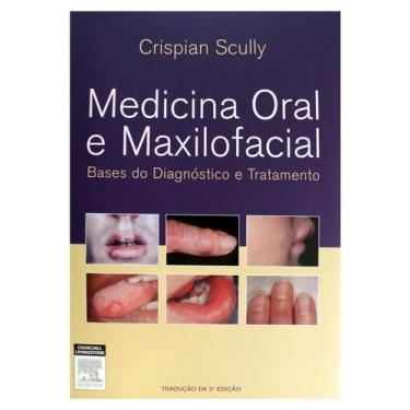 Imagem de Medicina Oral E Maxilofacial -  2ª Edição - Elsevier
