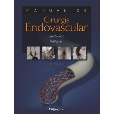 Imagem de Manual de cirurgia endovascular - Di Livros Editora Ltda
