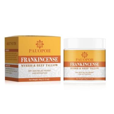 Imagem de PAUOPOH Bálsamo de olíbano – hidratante corporal nutritivo para pele seca, mãos e calcanhares – textura sedosa, não oleosa, mistura de óleos essenciais para todos os tipos de pele
