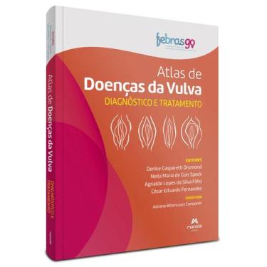 Imagem de Livro - Atlas de doenças da vulva