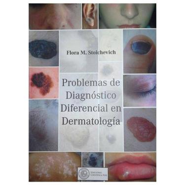 Imagem de Problemas De Diagnostico Diferencial En Dermatologia (Espanhol)