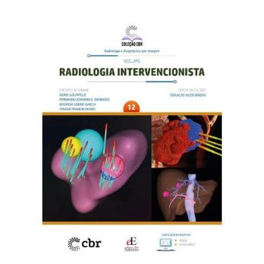 Imagem de Coleção Cbr Volume 12: Radiologia Intervencionista