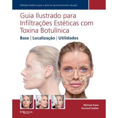 Imagem de Guia Ilustrado Para Infiltracoes Esteticas Com Toxina Botulinica