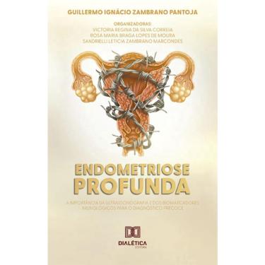 Imagem de Endometriose Profunda: a importância da ultrassonografia e dos biomarcadores imunológicos para o diagnóstico precoce