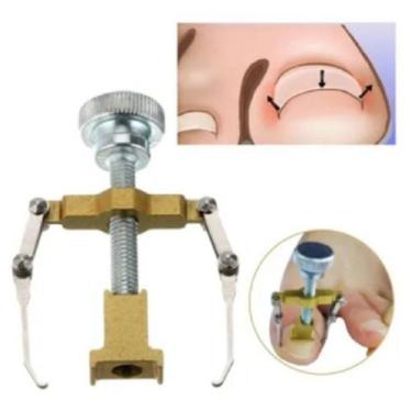 Imagem de Desencravador unhas Podologa Podologia Aparelho desencrava - A.R Varie