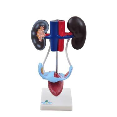 Imagem de Sistema Urinário Feminino em 4 Partes Anatomia