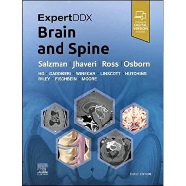 Imagem de Expertddx: Brain And Spine - Elsevier (Import)