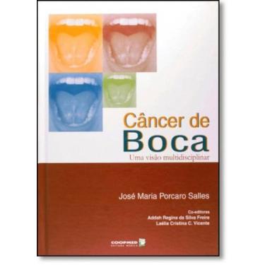 Imagem de Câncer de Boca: Uma Visão Multidisciplinar - Coopmed