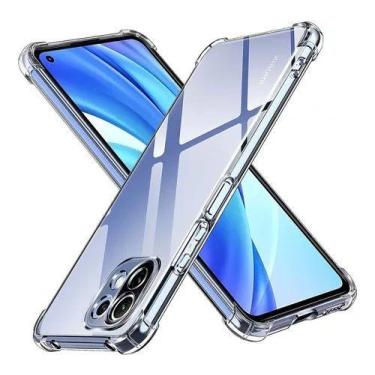 Imagem de Capa Case Xiaomi Mi 11 Lite 5g Ne + Pelicula Vidro 3d 5d 9d - Universo