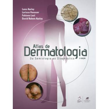 Imagem de Livro - Atlas de Dermatologia - Da Semiologia ao Diagnóstico
