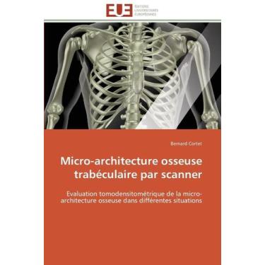 Imagem de Micro-Architecture Osseuse Trabéculaire Par Scanner
