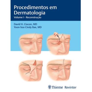 Imagem de Livro - Procedimentos em Dermatologia