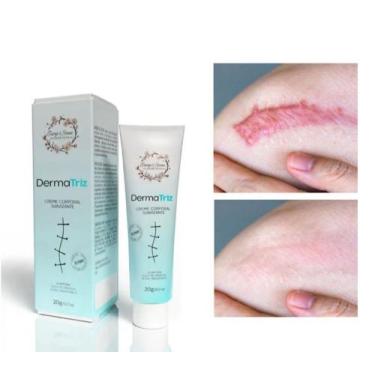 Imagem de Pomada Creme, colágeno Para Cicatriz Estrias DermaTriz 20g - Tiarga & 