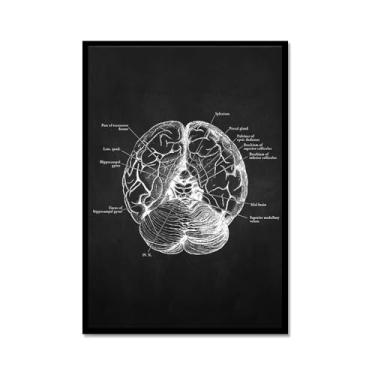 Imagem de Fundo preto anatomia humana arte médica impressões em tela imagens esqueleto músculo pôster vintage educação pintura arte decoração de parede (SKU7,12x40,6 cm = (30 x 40 cm), moldura de metal preto)