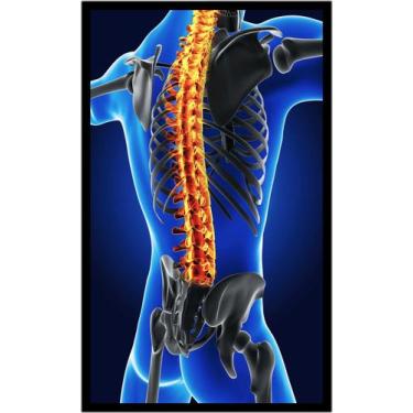 Imagem de Quadro Decorativo Medicina Médicos Fisioterapia Ortopedia Coluna Cervi