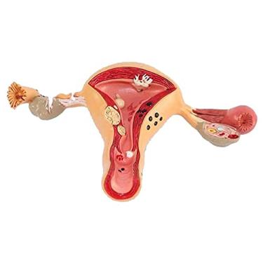 Imagem de AMDHZ Modelo de Lesão Uterina Órgão Humano Anatômico Ciência Modelo de Órgãos Internos e Externos Feminino Modelo de Órgãos
