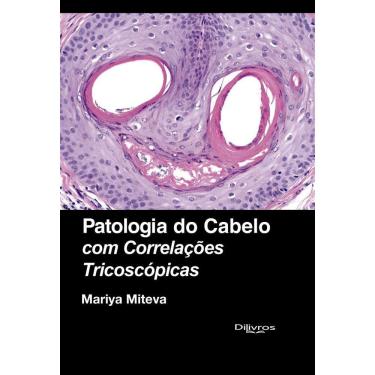 Imagem de Patologia do Cabelo com Correlações Tricoscopias