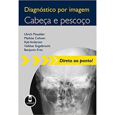 Imagem de Diagnostico Por Imagem - Cabeca E Pescoco