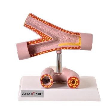 Imagem de Artéria Saudável e Patológica Anatomia Anatomic