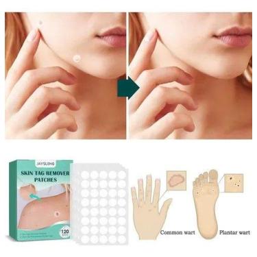 Imagem de Curativo Invisível Para Verruga No Rosto Skin Tag Remover Patches 36un
