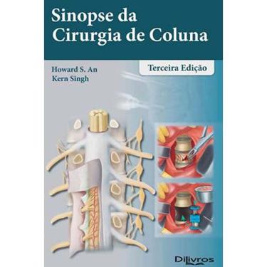 Imagem de Sinopse Da Cirurgia De Coluna