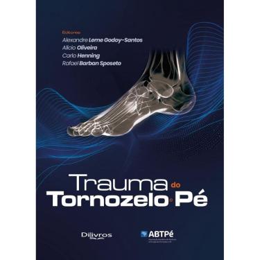 Imagem de Trauma Do Tornozelo E Pe