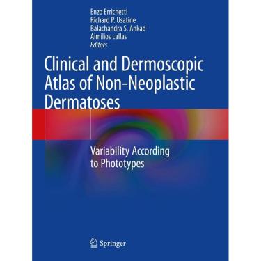 Imagem de Clinical And Dermoscopic Atlas Of Non Neoplastic Dermatoses