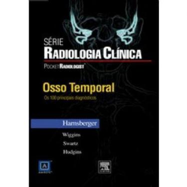 Imagem de Osso Temporal - Principais Diagnósticos - Editora: Elsevier Brasil