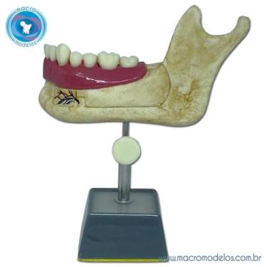 Imagem de Modelo Hemi Mandibula de Jovem - Macro Modelos