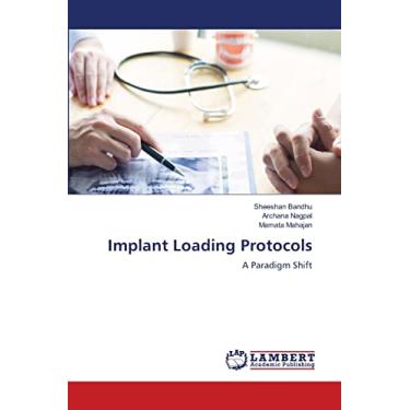 Imagem de Implant Loading Protocols: A Paradigm Shift