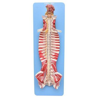 Imagem de Tronco Cerebral Espinhal Natural