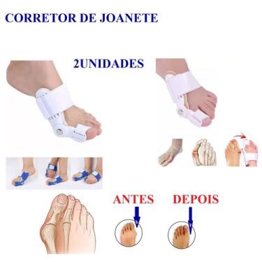 Imagem de 1 Par Corretor De Pé Protetor Ortopédico Articulado Para Joanete - EMB