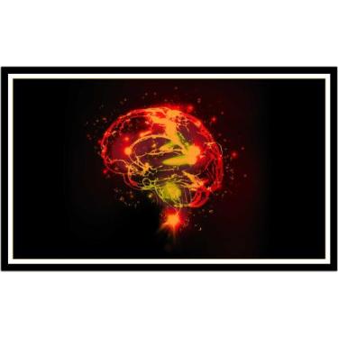 Imagem de Quadro Decorativo Medicina Médicos Cérebro Neurologia Psiquiatria Cons