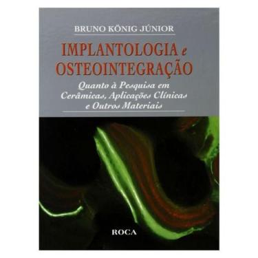 Imagem de Implantologia e osteointegracao - quanto a pesquisa com ceramicas e ou