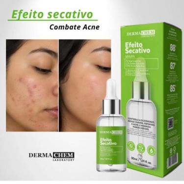 Imagem de Sérum Facial Efeito Secativo Dermachem - 30ml