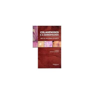 Imagem de Colagenoses e a Dermatologia - DI LIVROS