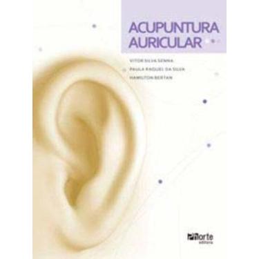Imagem de Acupuntura auricular - PHORTE, 3