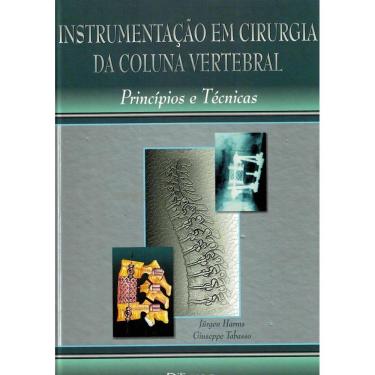 Imagem de Instrumentação em Cirurgia da Coluna Vertebral