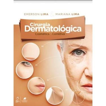 Imagem de Cirurgia Dermatologica Cosmetica E Corretiva
