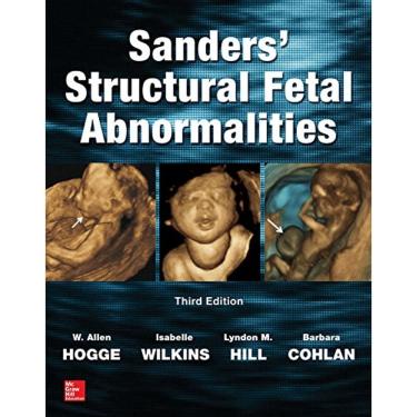 Imagem de Sandersstructural Fe Tal Abno Rmalities