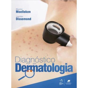 Imagem de Diagnostico em Dermatologia