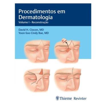 Imagem de Procedimentos Em Dermatologia