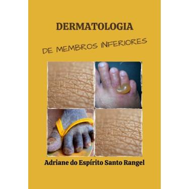 Imagem de Dermatologia de Membros Inferiores