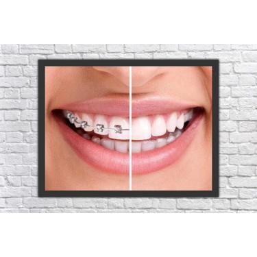 Imagem de Quadro Decorativo Dentista Odontologia Dentes Sorriso Consultórios Sal